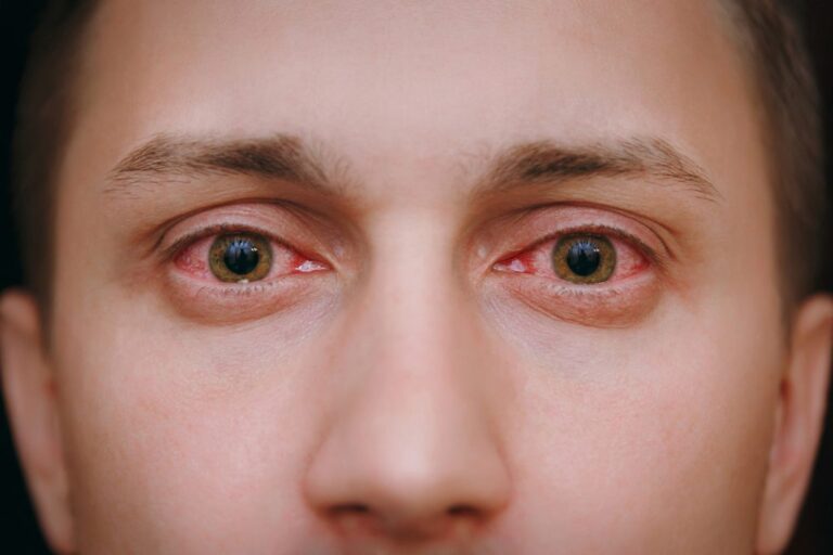 Air Pollution Emerging as Major Threat to Eye Health, Doctors Warn